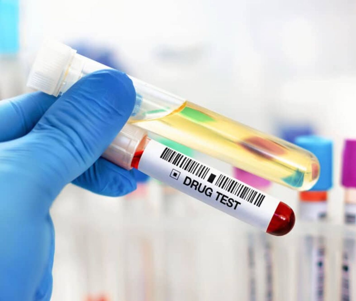 Technician labeling specimen sample